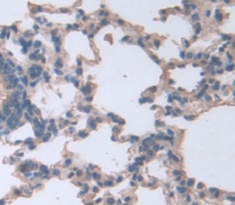 Polyclonal Antibody to Connexin 31 (CX31)