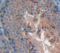 Polyclonal Antibody to Colony Stimulating Factor Receptor, Granulocyte (GCSFR)