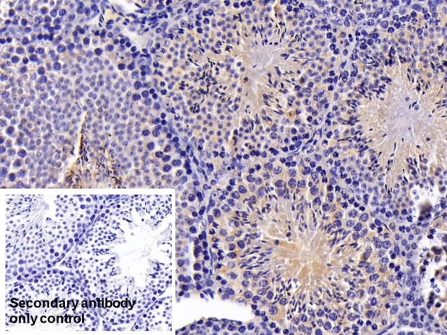 Polyclonal Antibody to Pancreatic Elastase 1 (ELA1)