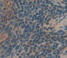 Polyclonal Antibody to Killer Cell Immunoglobulin Like Receptor 2DS4 (KIR2DS4)