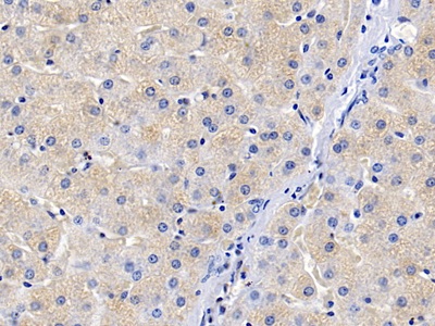 Polyclonal Antibody to Secondary Lymphoid Tissue Chemokine (SLC)