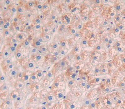 Polyclonal Antibody to Solute Carrier Family 25 Member 20 (SLC25A20)