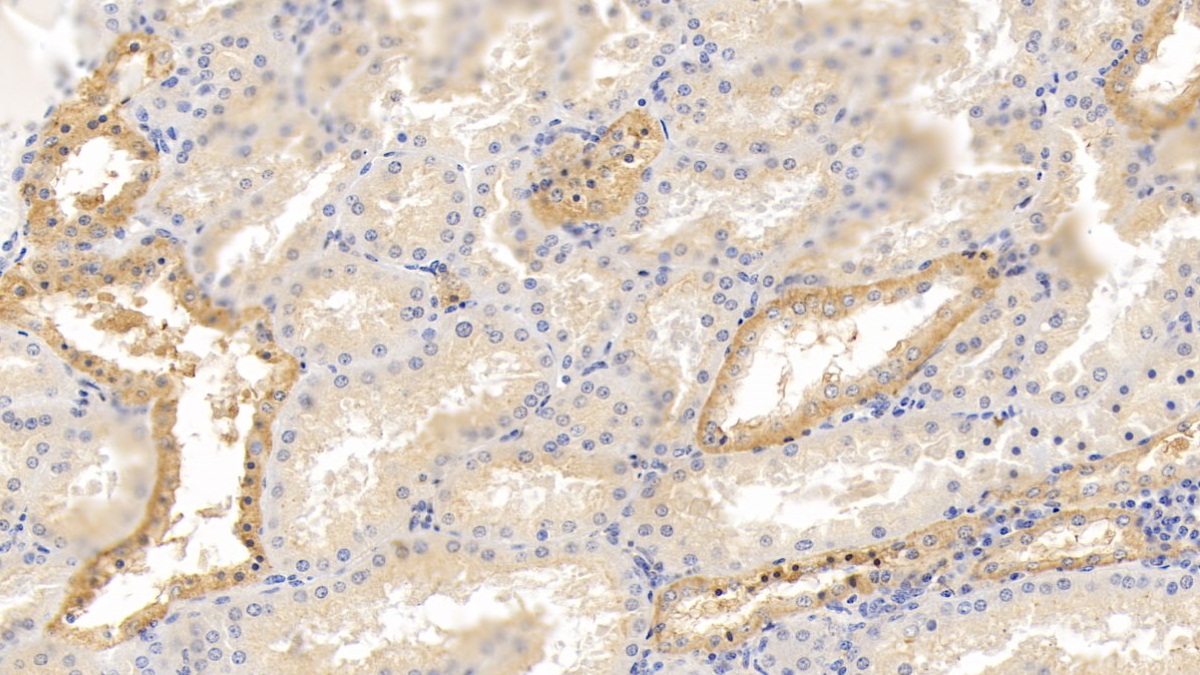 Polyclonal Antibody to Glucocorticoid Induced Tumor Necrosis Factor Receptor (GITR)