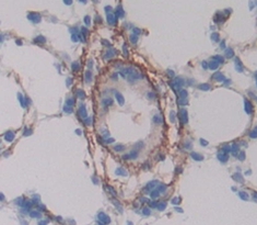 Polyclonal Antibody to Cluster Of Differentiation 146 (CD146)