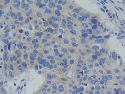 Polyclonal Antibody to Phosphofructokinase, Platelet (PFKP)