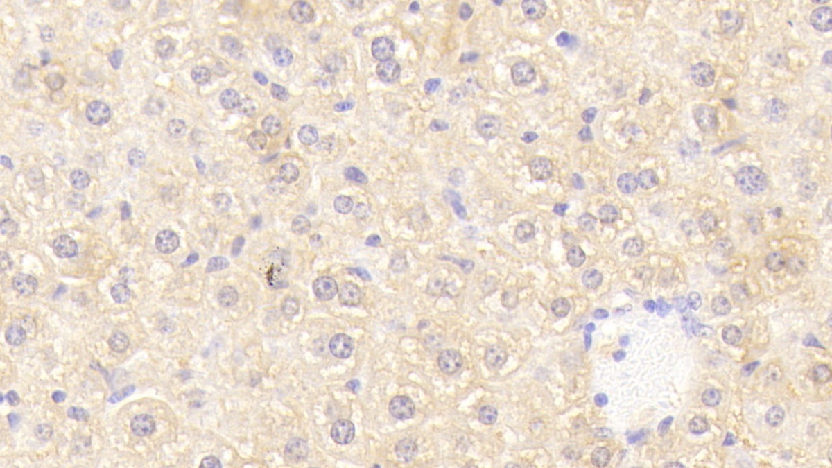 Polyclonal Antibody to Oncostatin M Receptor (OSMR)