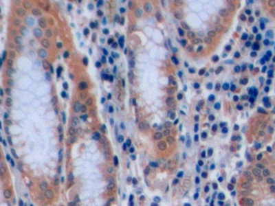 Polyclonal Antibody to Cluster Of Differentiation 7 (CD7)
