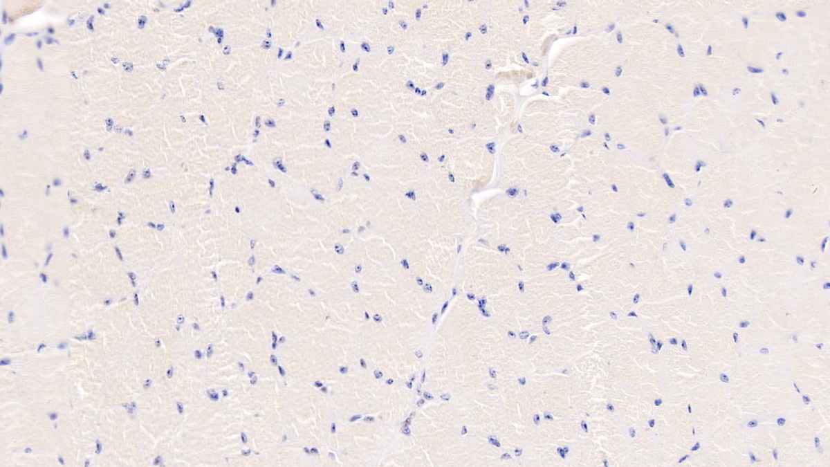 Polyclonal Antibody to S100 Calcium Binding Protein A8 (S100A8)