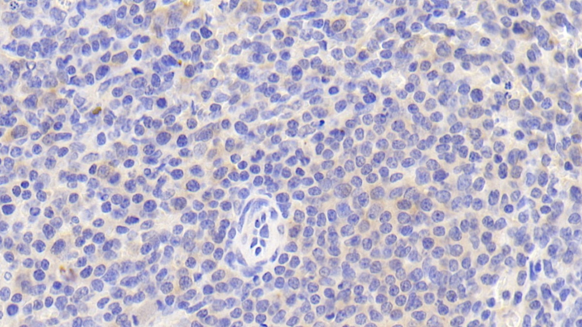 Polyclonal Antibody to Cluster Of Differentiation 5 (CD5)