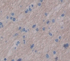Polyclonal Antibody to Jagged 1 (JAG1)