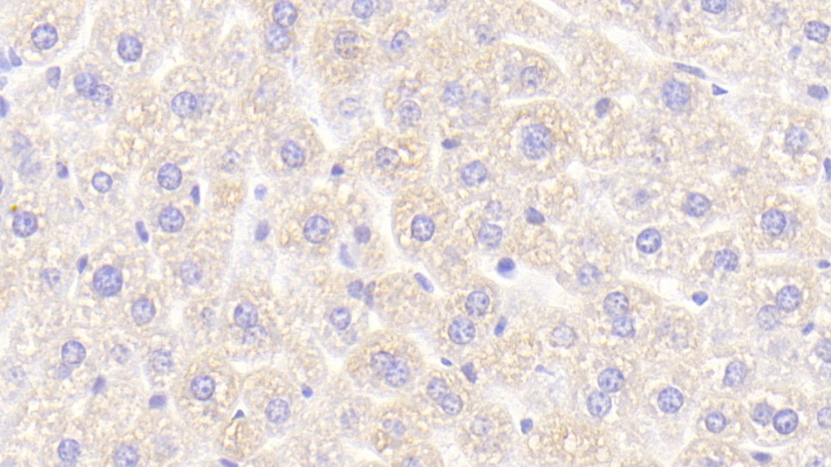 Polyclonal Antibody to Cholinergic Receptor, Nicotinic, Alpha 4 (CHRNa4)