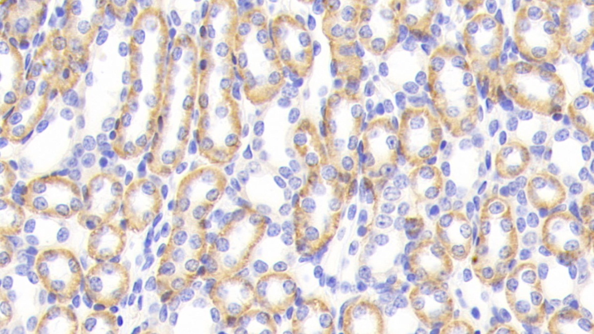 Polyclonal Antibody to Cathepsin S (CTSS)