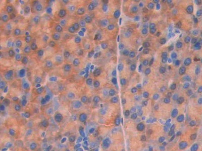 Polyclonal Antibody to Cluster Of Differentiation 34 (CD34)