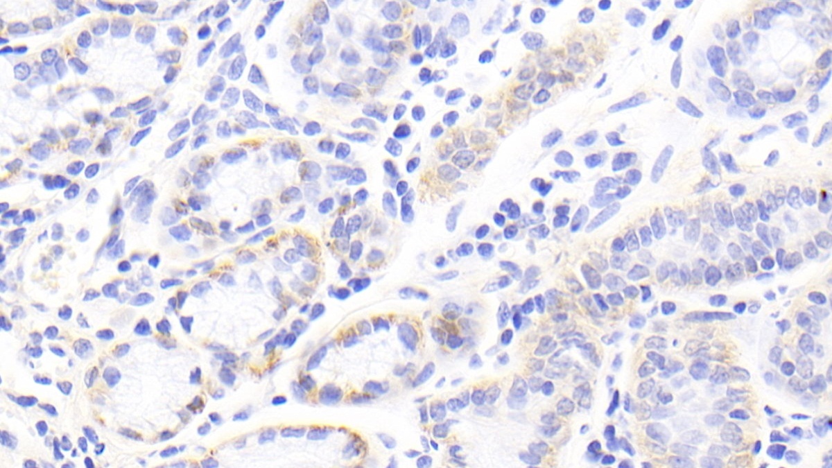 Polyclonal Antibody to Tenascin C (TNC)