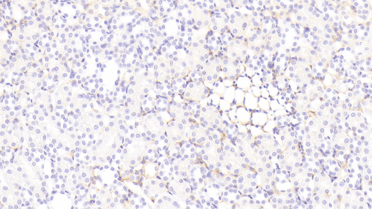 Polyclonal Antibody to Tenascin C (TNC)
