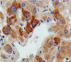 Polyclonal Antibody to Hepcidin (Hepc)