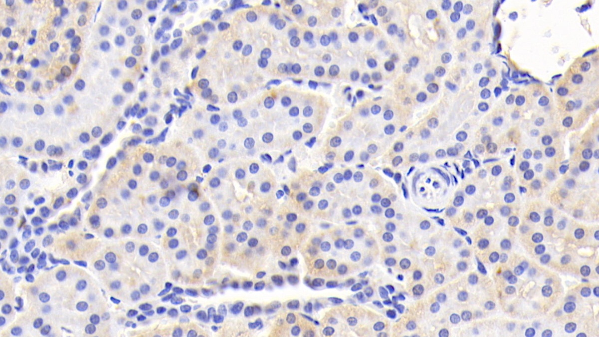Polyclonal Antibody to Hemojuvelin (HJV)