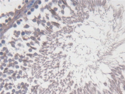 Polyclonal Antibody to Cytochrome P450 17A1 (CYP17A1)