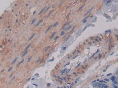 Polyclonal Antibody to Macrophage Inflammatory Protein 1 Gamma (MIP1g)