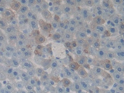Polyclonal Antibody to Growth Differentiation Factor 1 (GDF1)
