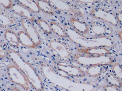 Polyclonal Antibody to Collagen Type IV Alpha 3 (COL4a3)