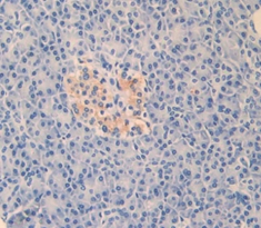 Polyclonal Antibody to Left/Right Determination Factor 1 (LEFTY1)