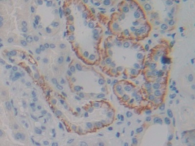 Polyclonal Antibody to Ciliary Neurotrophic Factor Receptor (CNTFR)