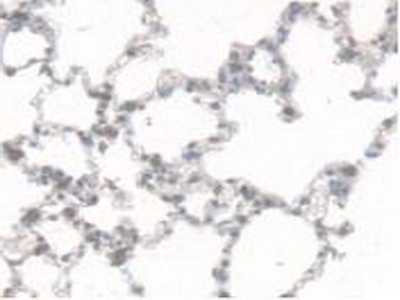 Polyclonal Antibody to Carboxylesterase 1 (CES1)