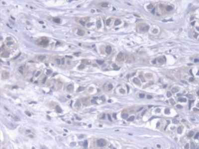 Polyclonal Antibody to Dystonin (DST)