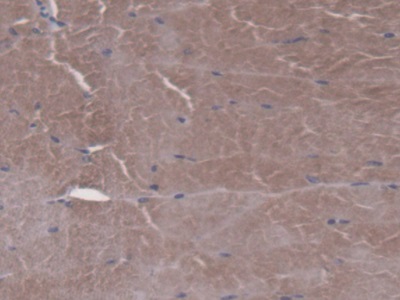 Polyclonal Antibody to Folylpolyglutamate Synthase, Mitochondrial (FPGS)