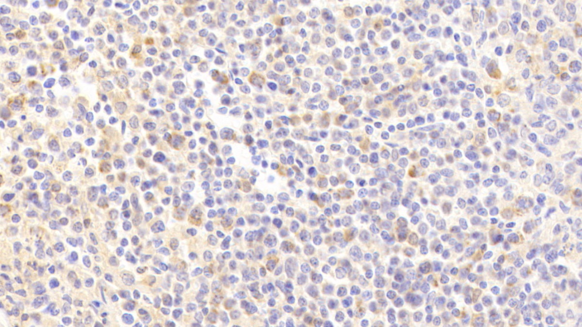 Polyclonal Antibody to Hemopoietic Cell Kinase (HCK)