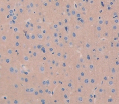 Polyclonal Antibody to Islet Cell Autoantigen 1 (ICA1)