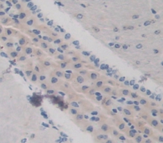 Polyclonal Antibody to Keratocan (KERA)