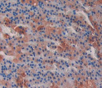 Polyclonal Antibody to Mitochondrial Tumor Suppressor 1 (MTUS1)