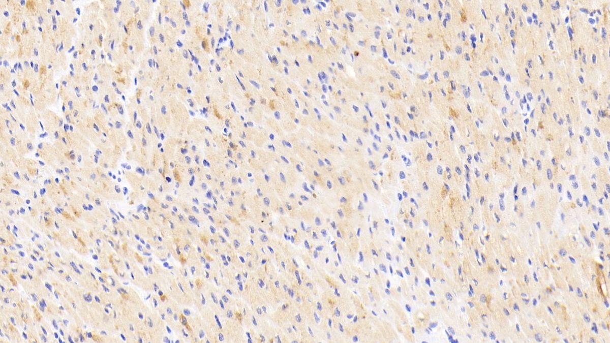Polyclonal Antibody to Neuro Oncological Ventral Antigen 1 (NOVA1)