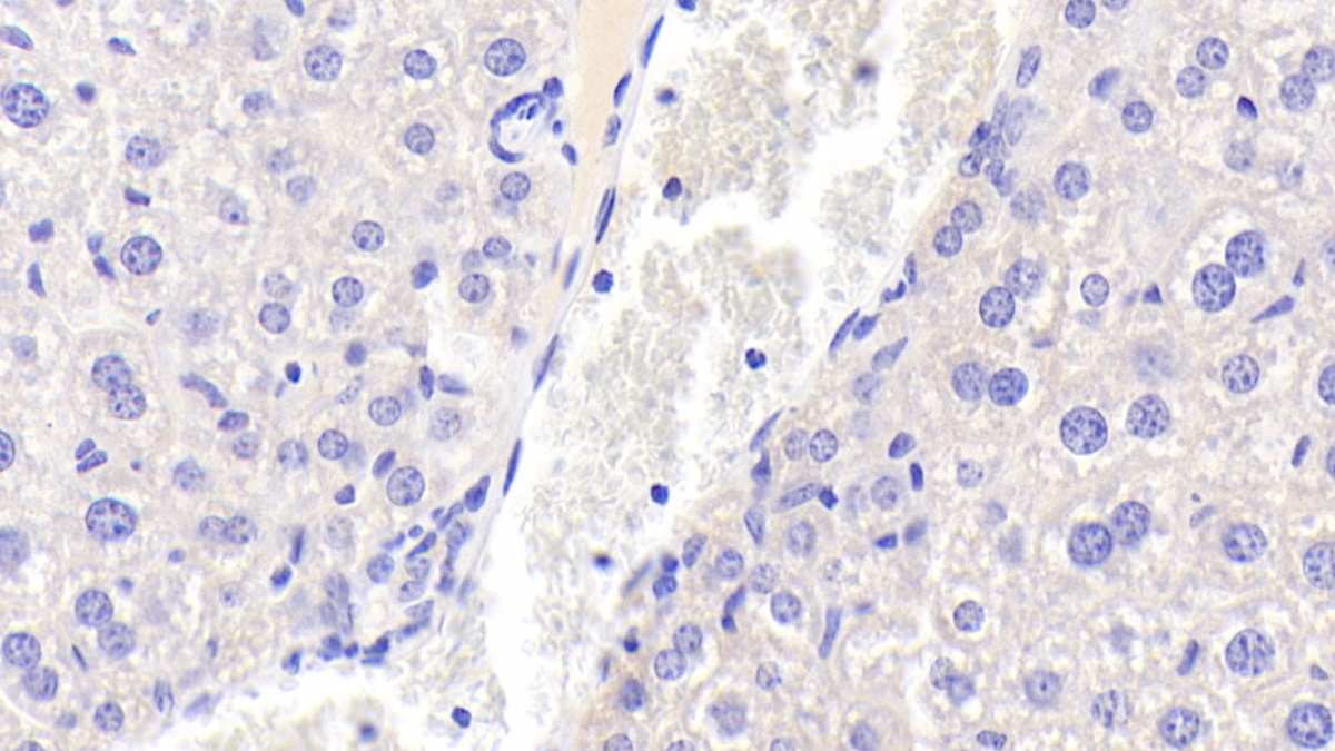 Polyclonal Antibody to Osteoglycin (OGN)