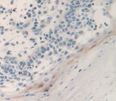 Polyclonal Antibody to Prostate Stem Cell Antigen (PSCA)