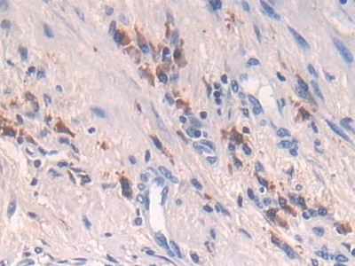 Polyclonal Antibody to Parathyroid Hormone Receptor 1 (PTHR1)
