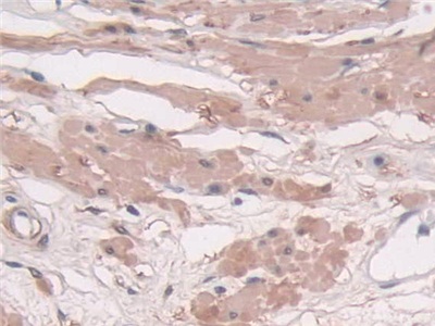 Polyclonal Antibody to Transgelin (TAGLN)