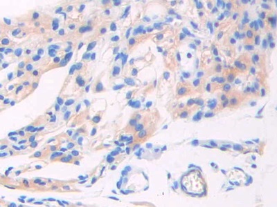 Polyclonal Antibody to Glutamate Decarboxylase 1, Brain (GAD1)