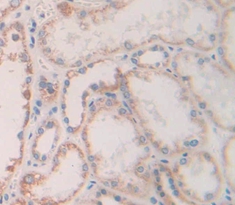 Polyclonal Antibody to Fibroblast Growth Factor 13 (FGF13)