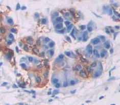 Polyclonal Antibody to Neutral Sphingomyelinase (NSMASE)