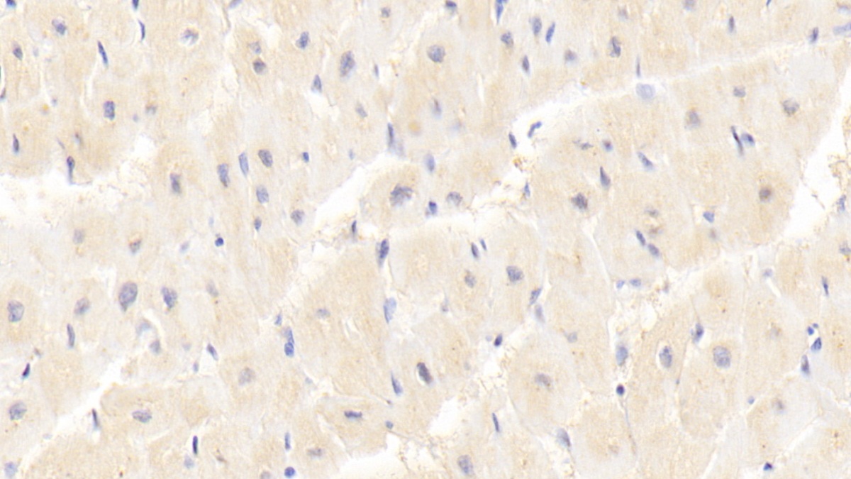 Polyclonal Antibody to Protein Kinase, AMP Activated Gamma 1 (PRKAg1)