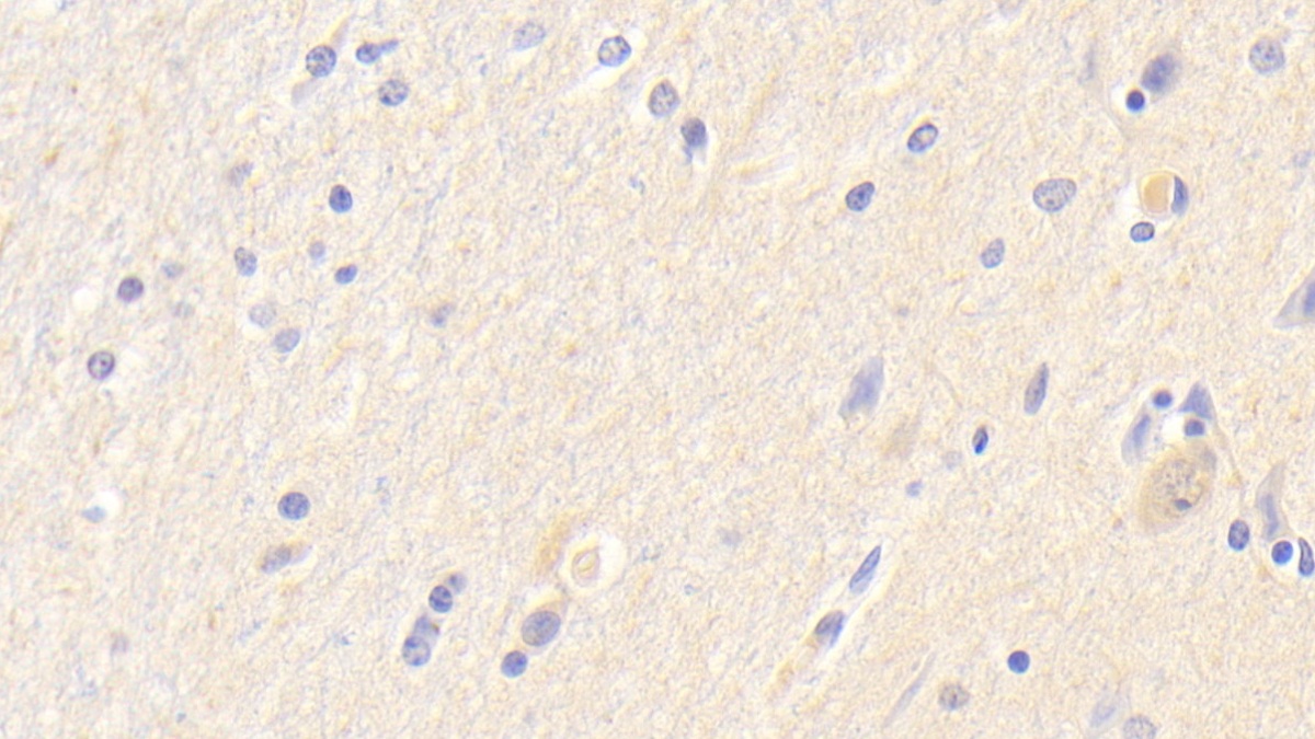 Polyclonal Antibody to Neuroserpin (NSP)