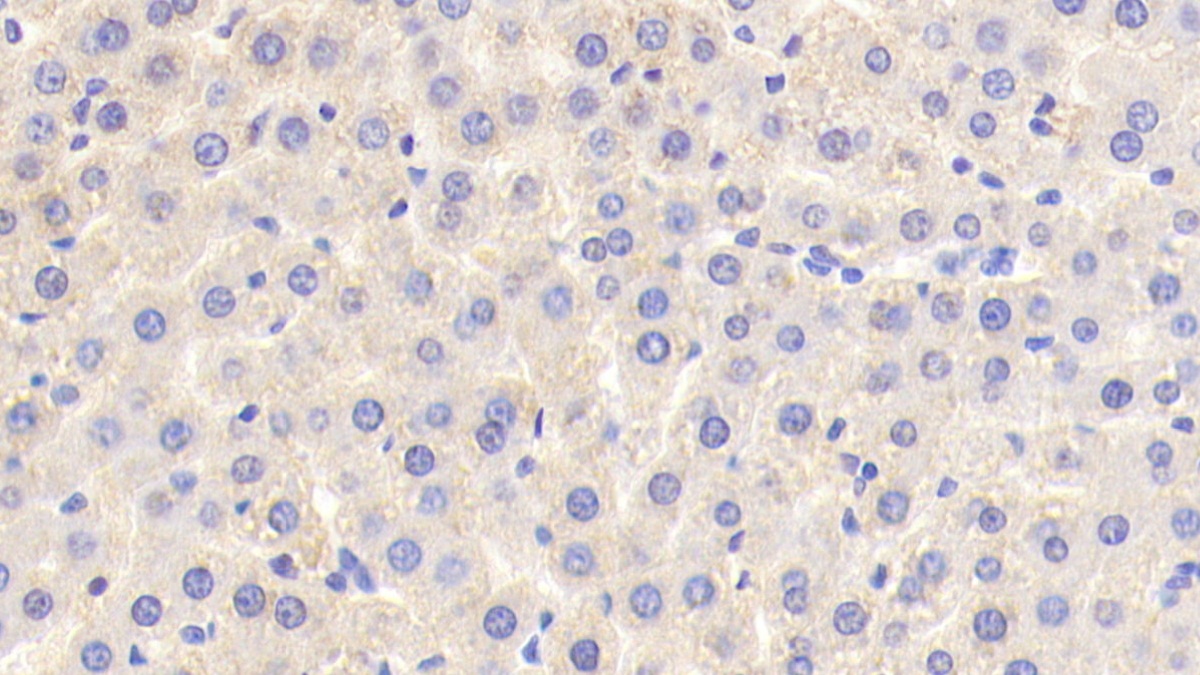 Polyclonal Antibody to Phosphofructokinase, Liver (PFKL)