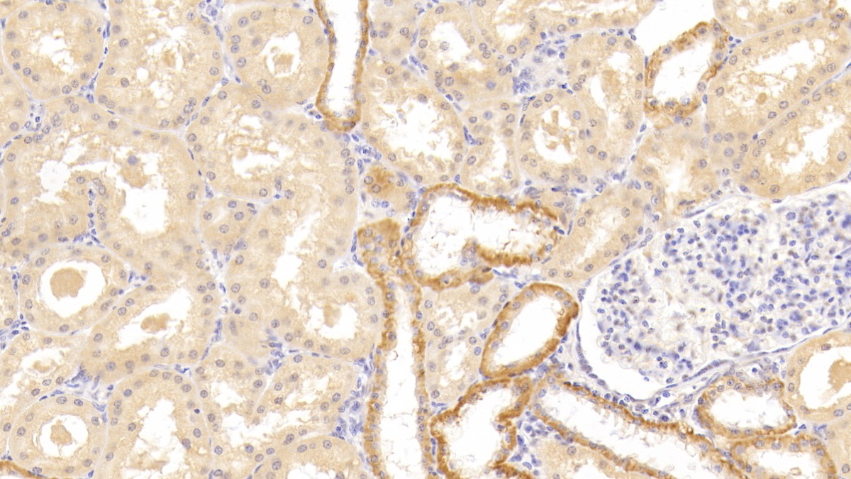 Polyclonal Antibody to Tumor Necrosis Factor Receptor Superfamily, Member 14 (TNFRSF14)