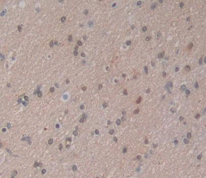 Polyclonal Antibody to Nuclear Receptor Related Protein 1 (NURR1)
