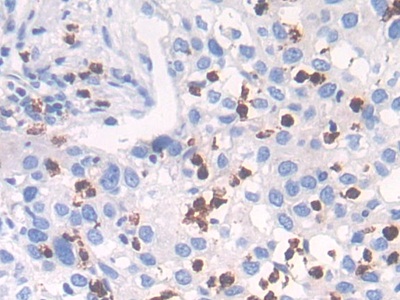 Polyclonal Antibody to Cathepsin G (CTSG)