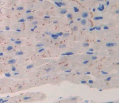 Polyclonal Antibody to Calcium Channel, Voltage Dependent, T-Type, Alpha 1H Subunit (CACNa1H)