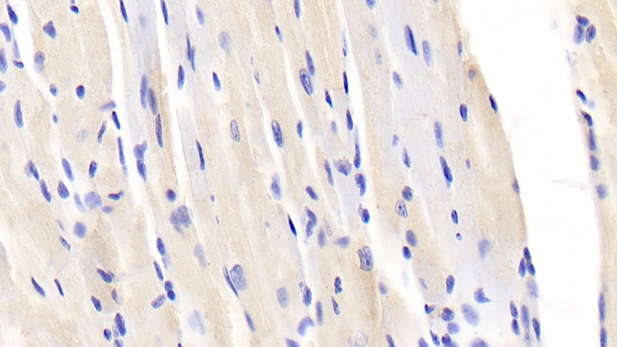 Polyclonal Antibody to Secreted Frizzled Related Protein 1 (SFRP1)